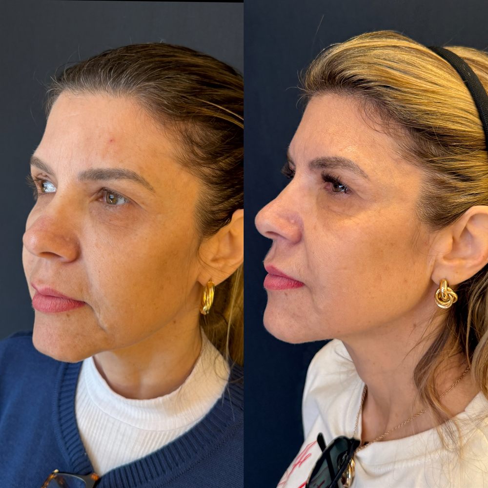 Comparativo de antes e depois — Caso 02