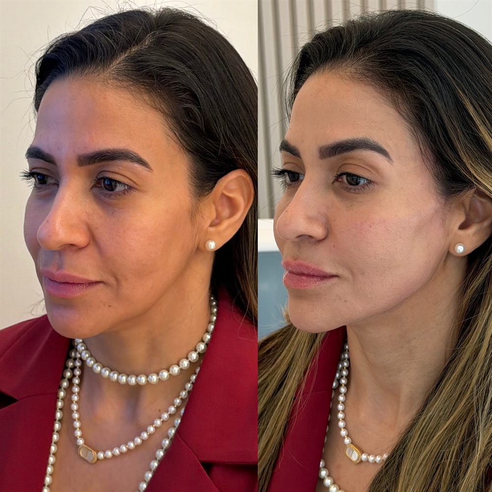 Comparativo de antes e depois — Caso 05