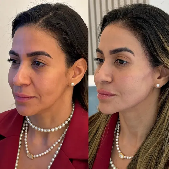 Comparativo de antes e depois — Caso 05