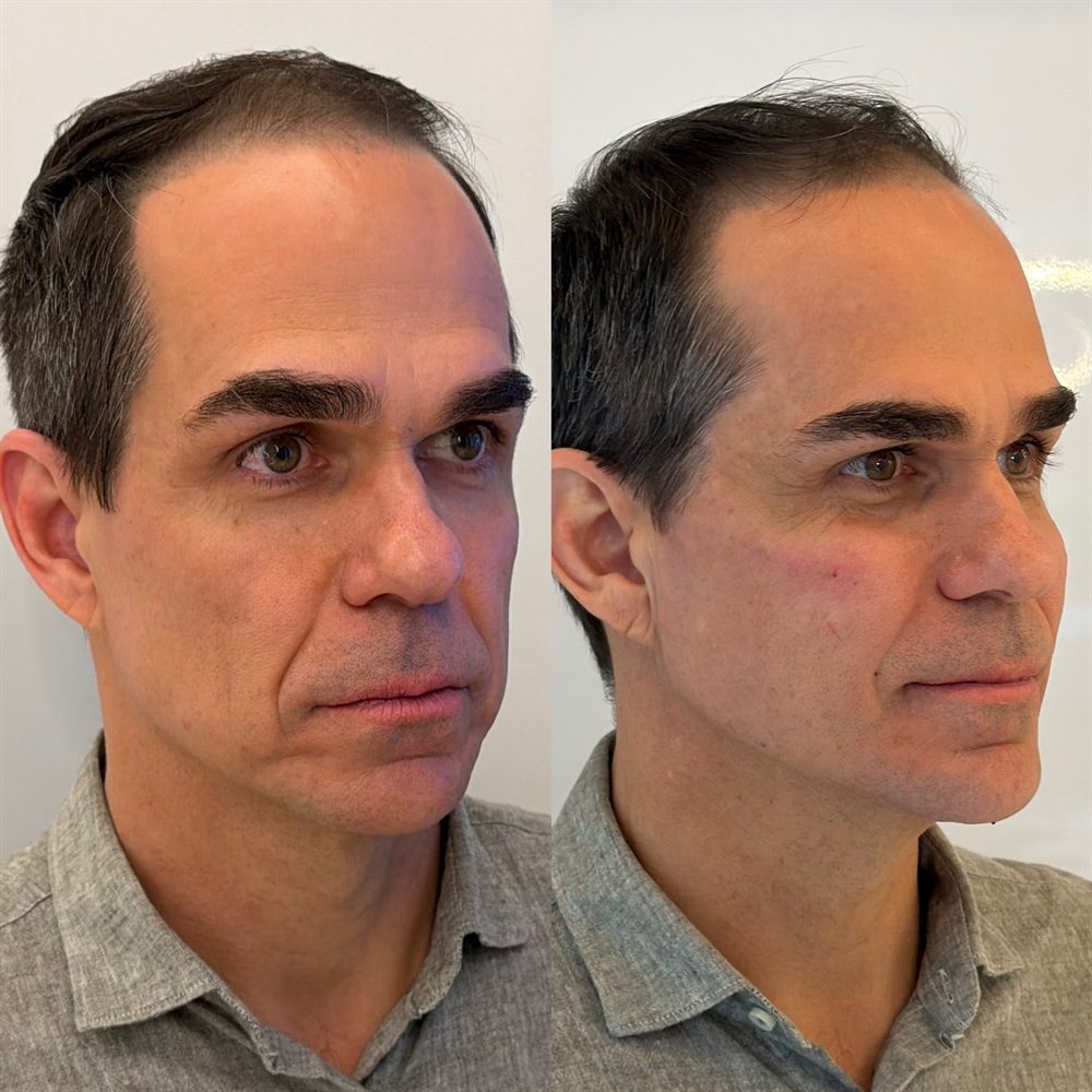 Comparativo de antes e depois — Caso 06