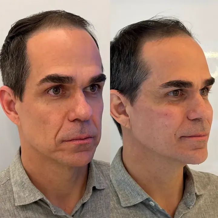 Comparativo de antes e depois — Caso 06